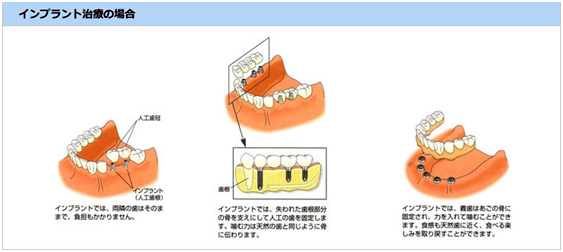 従来の治療法