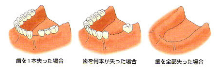 診査と治療計画る